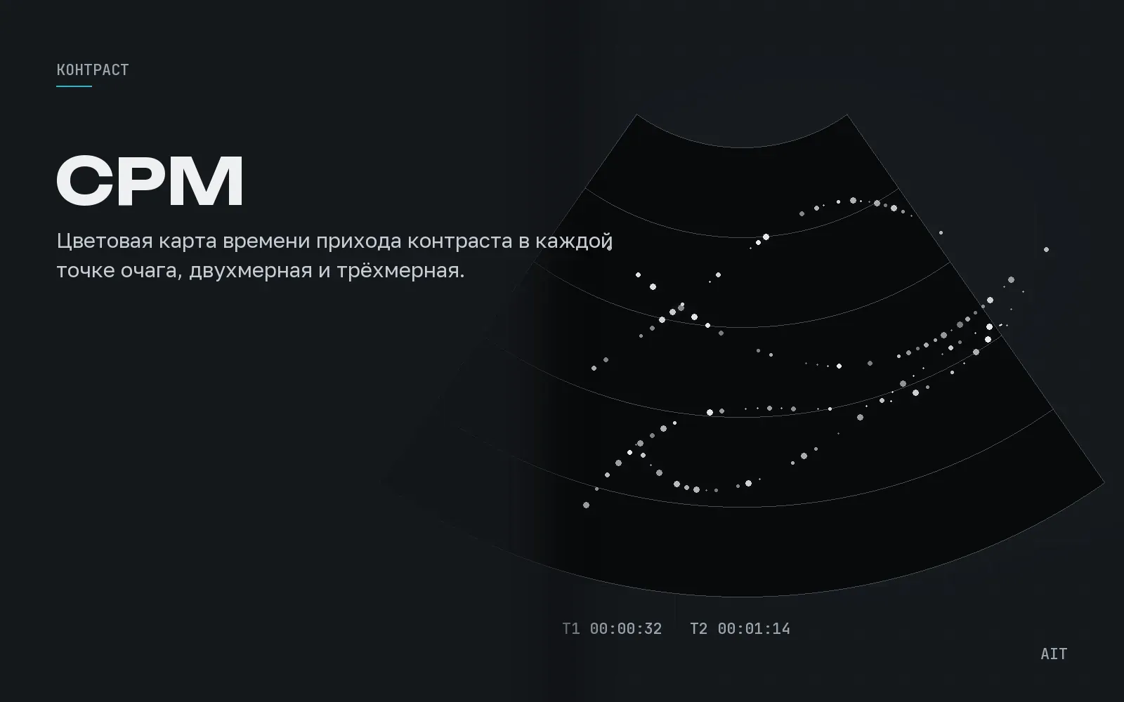 CEUS CPM, хроно-параметрическая карта