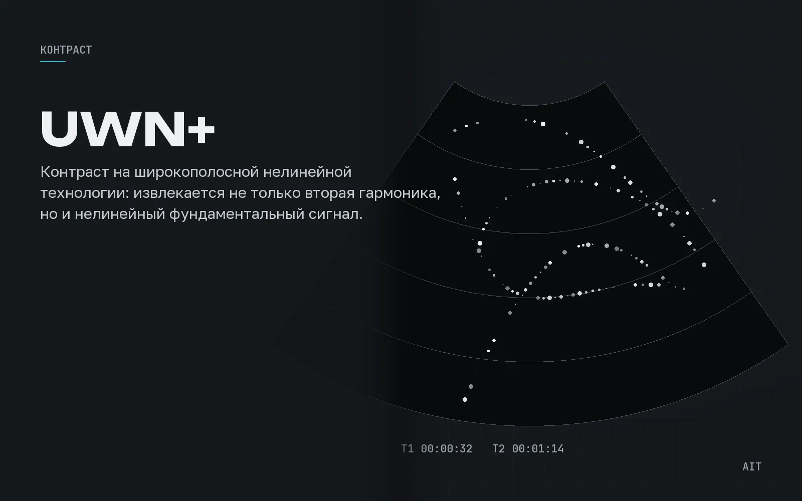 UWN+ Contrast Imaging, контрастная визуализация, иллюстрация