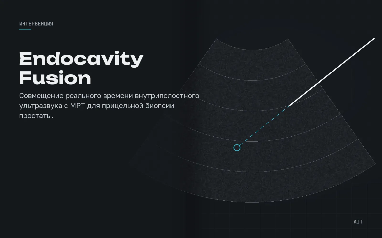 Endocavity Fusion Imaging, совмещение с МРТ для простаты