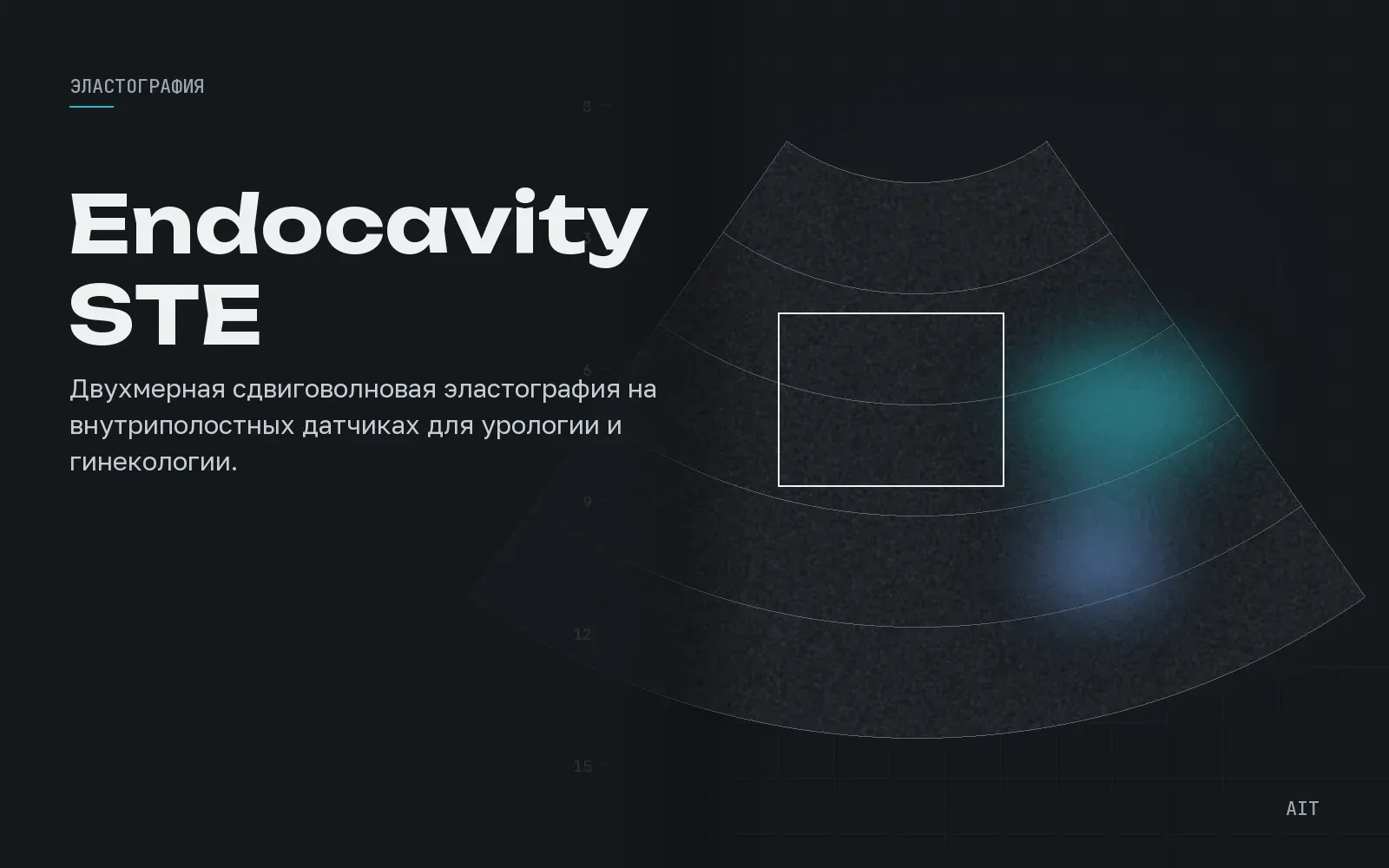 Endocavity STE, внутриполостная эластография