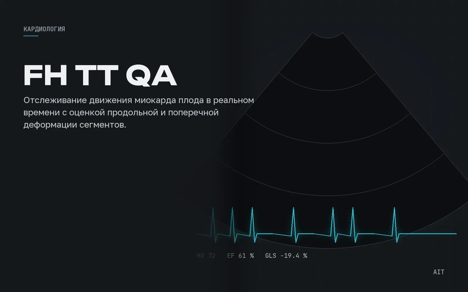 FH Tissue Tracking QA, трекинг миокарда плода