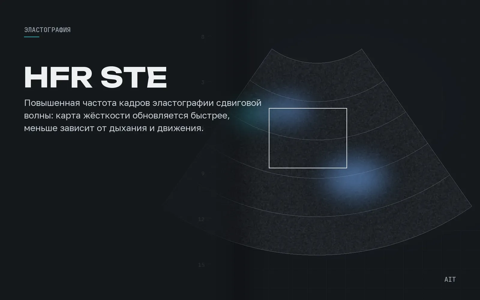 High Frame Rate STE