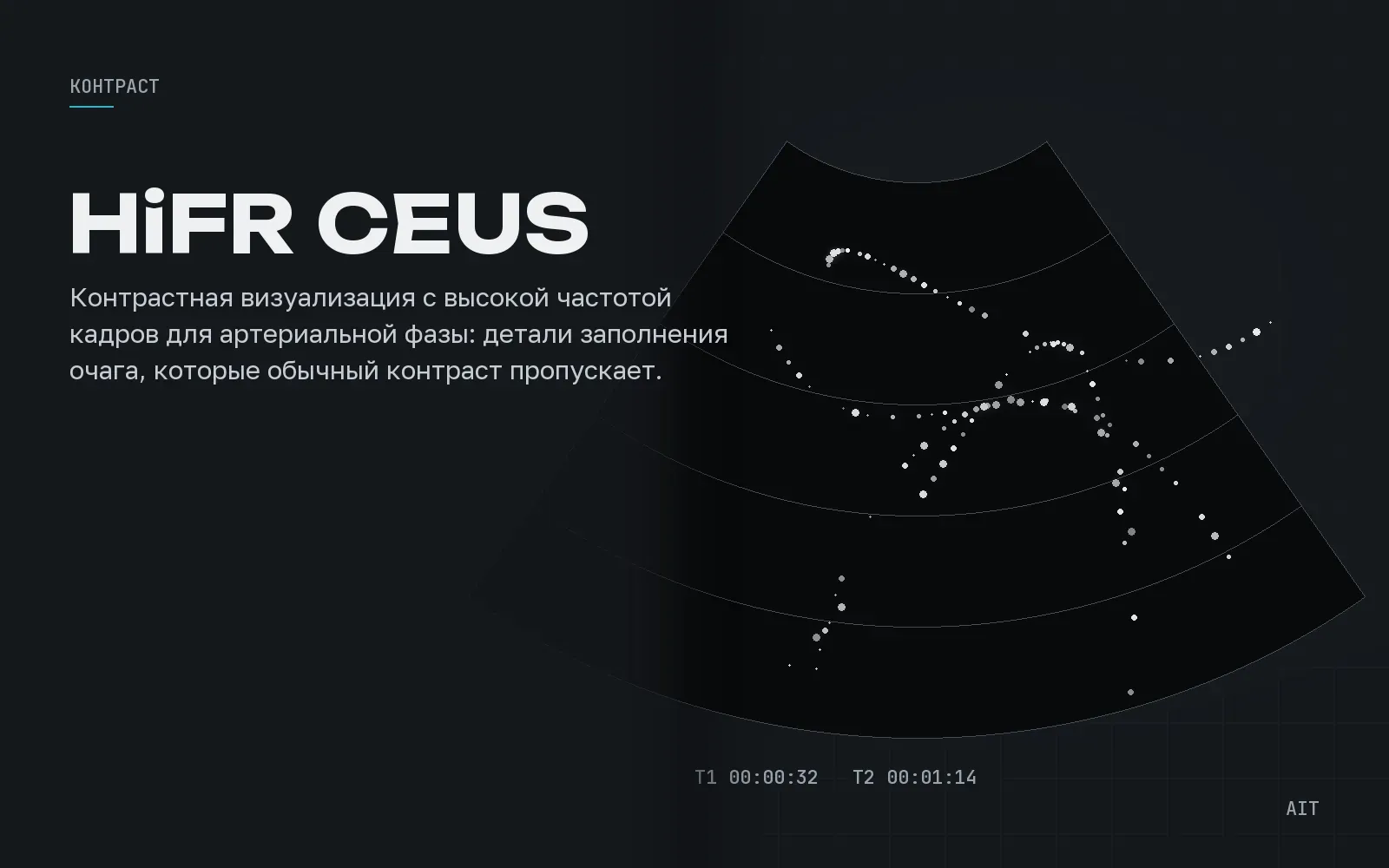 HiFR CEUS, контраст с высокой частотой кадров, иллюстрация