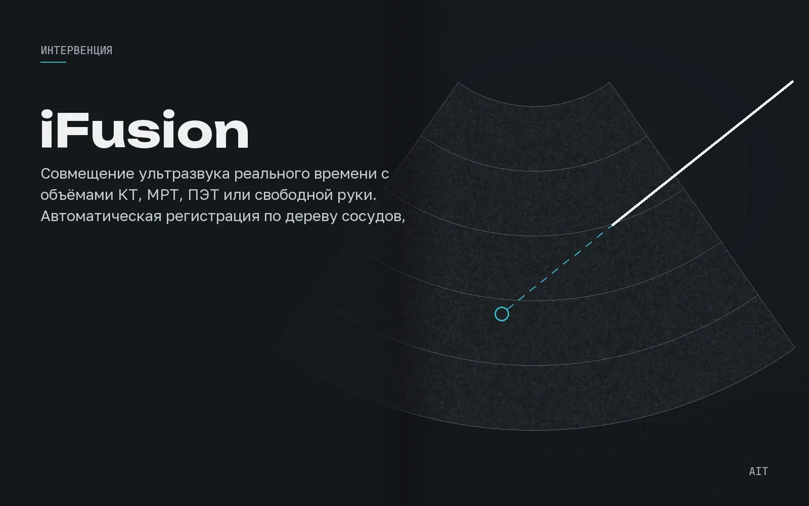 Ultrasound Fusion Imaging, совмещение с КТ, МРТ и ПЭТ