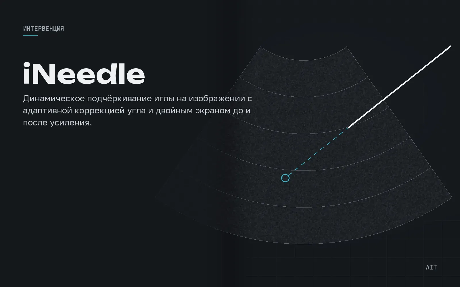 iNeedle, усиление визуализации иглы
