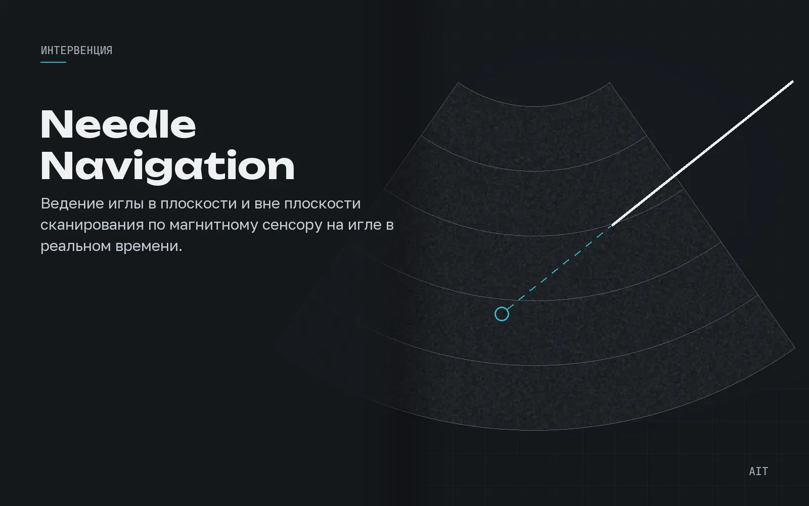 Needle Navigation, навигация иглы