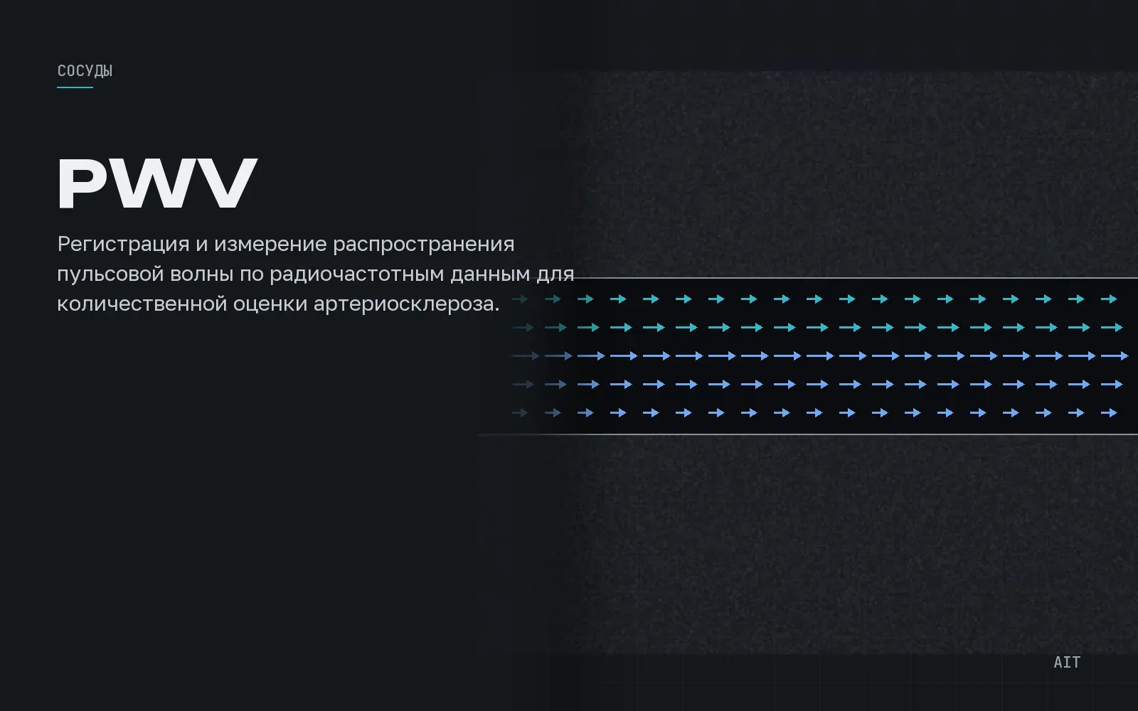 Arterial PWV Analysis, скорость пульсовой волны