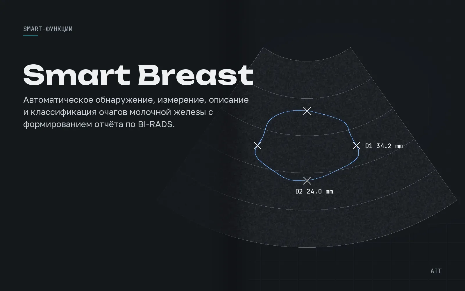 Smart Breast, классификация очагов по BI-RADS, иллюстрация