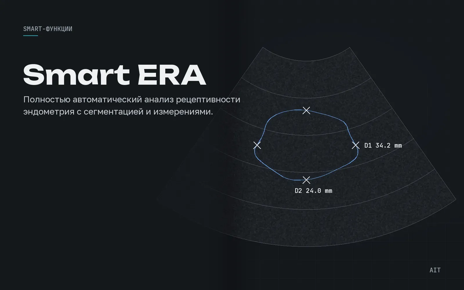 Smart ERA, рецептивность эндометрия