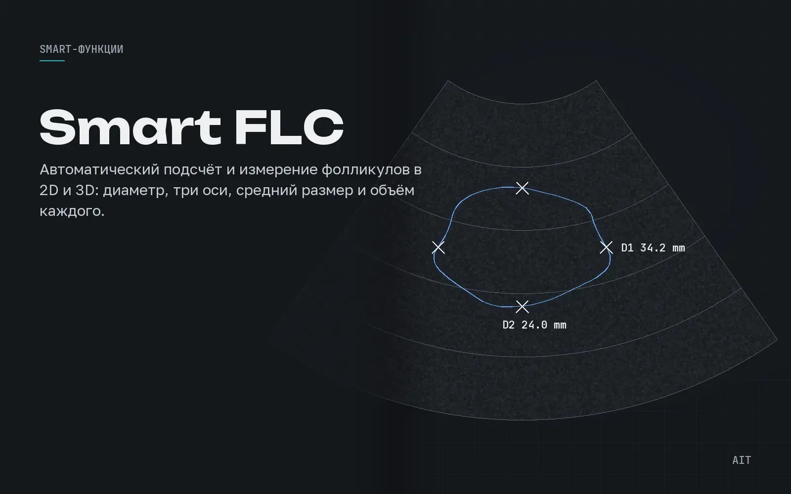 Smart FLC, фолликулометрия