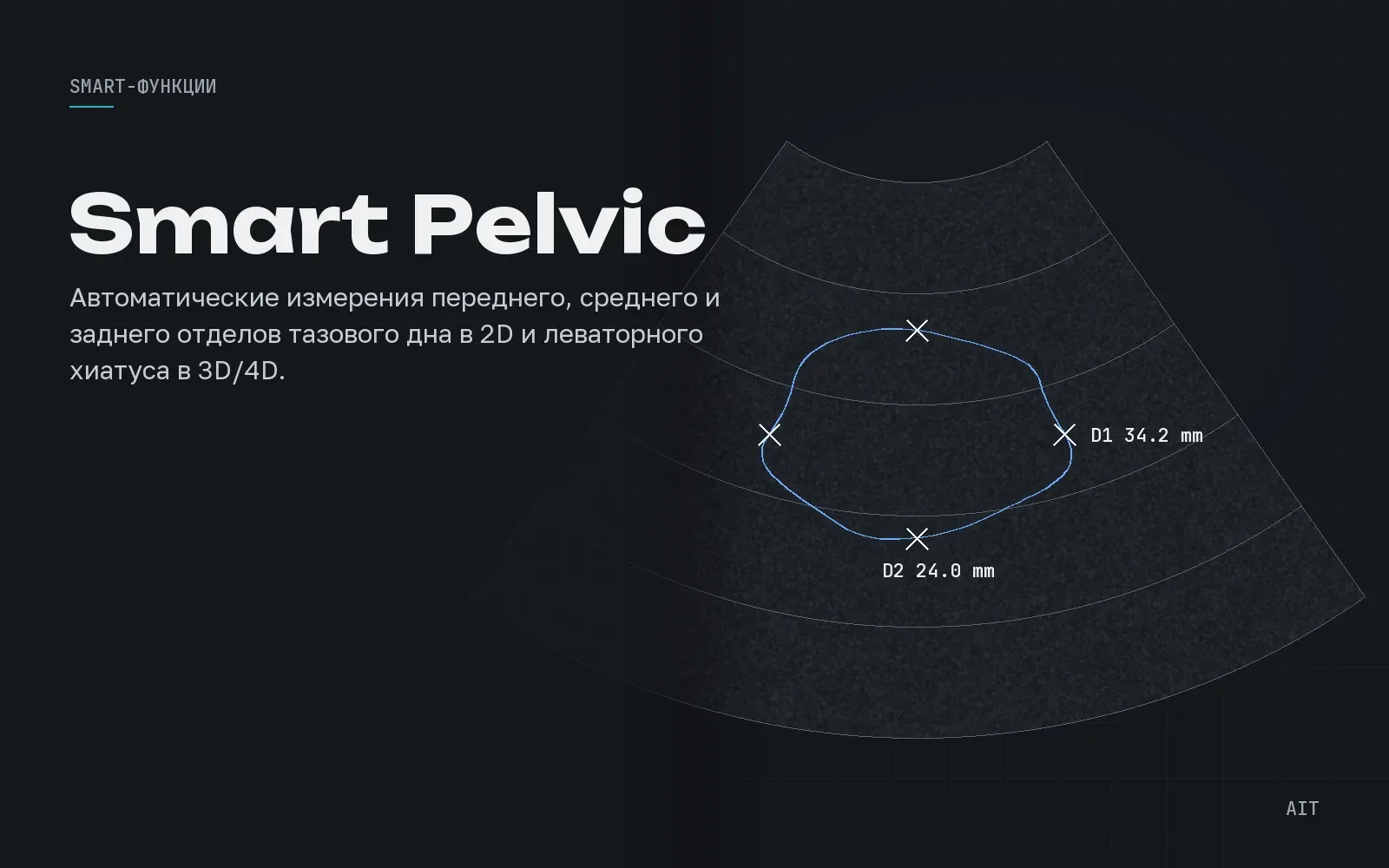 Smart Pelvic, тазовое дно