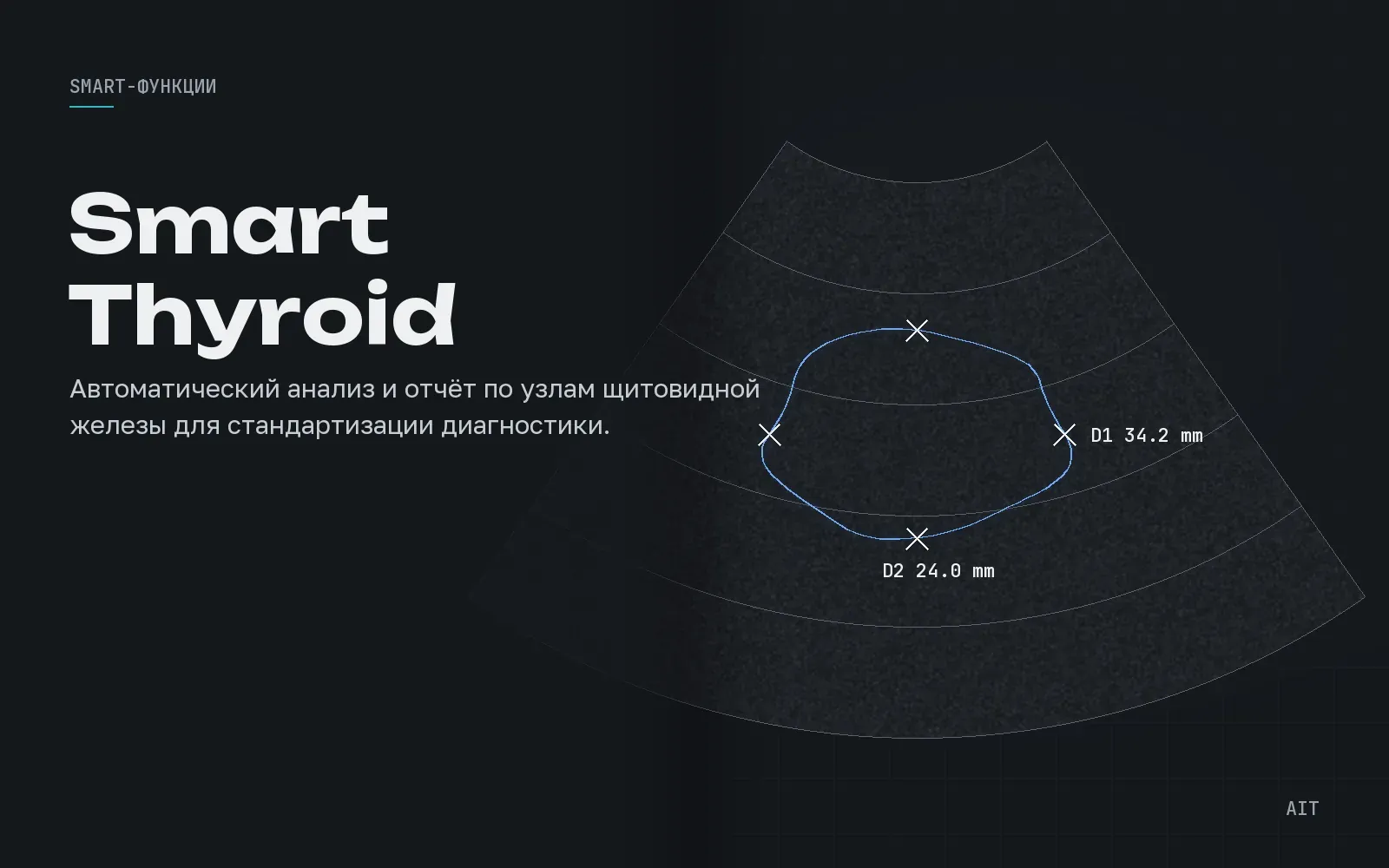 Smart Thyroid, классификация узлов по TI-RADS