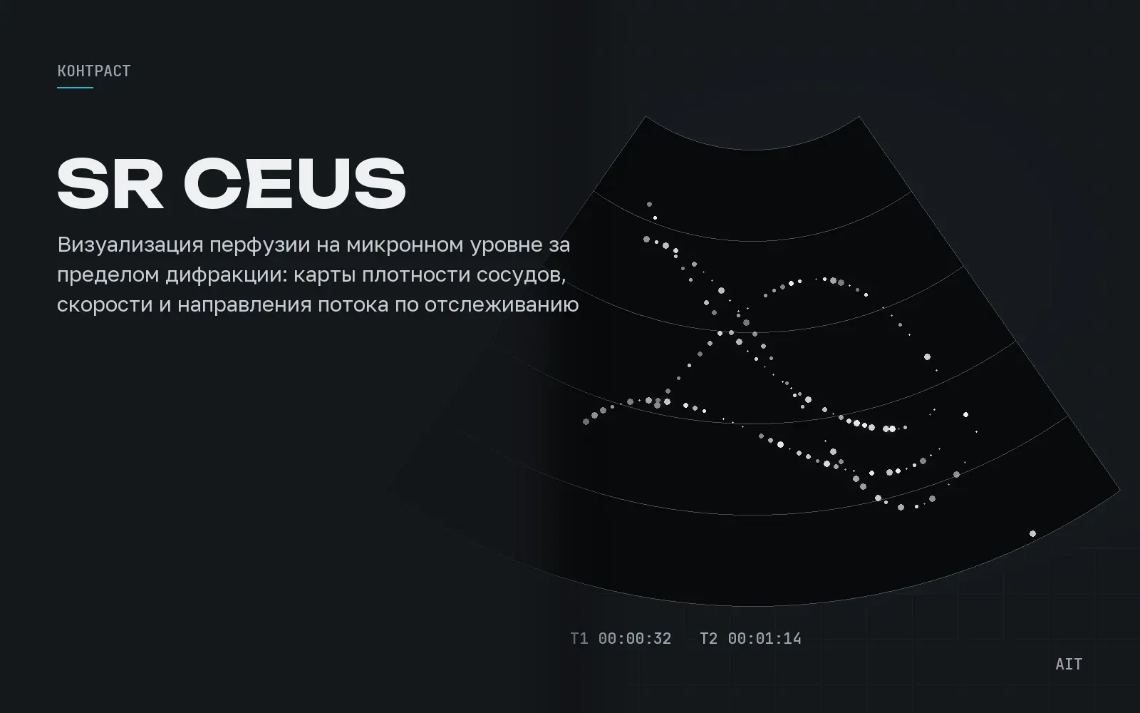 Super Resolution CEUS, контраст сверхразрешения
