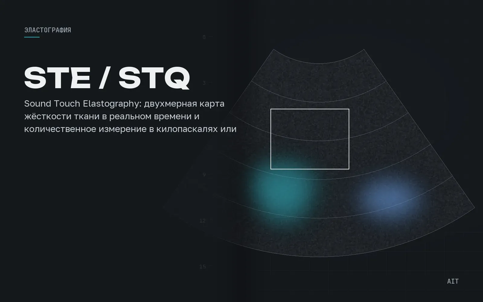 STE и STQ, эластография сдвиговой волны