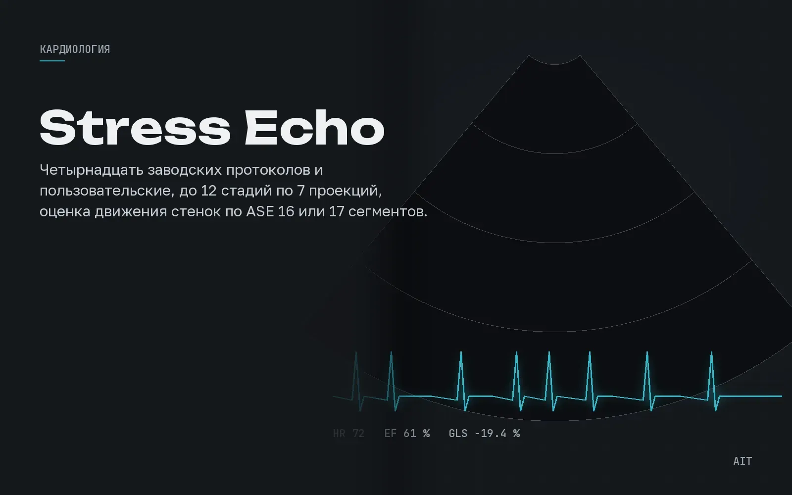 Stress Echo, стресс-эхокардиография