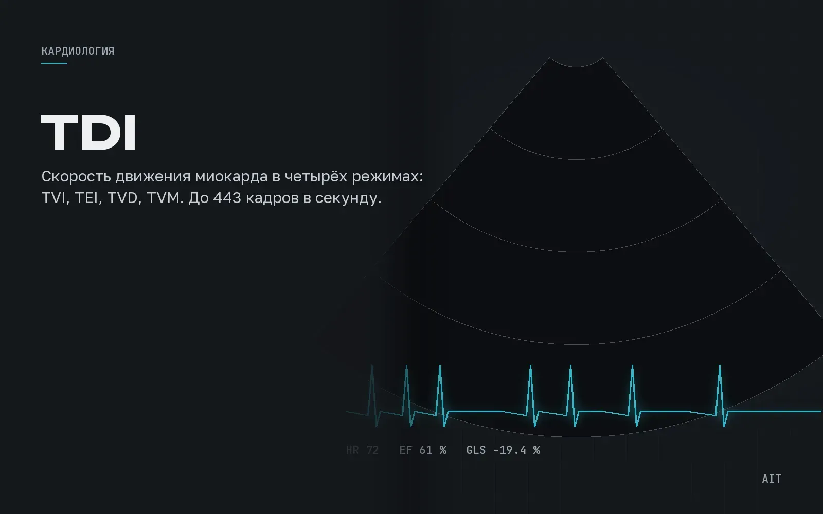 TDI, тканевой допплер