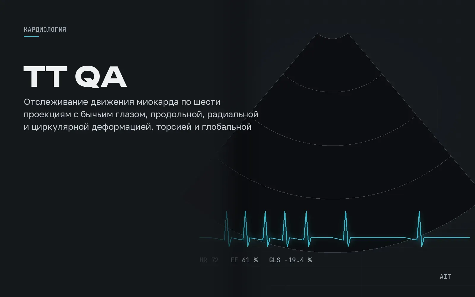 Tissue Tracking QA, спекл-трекинг и глобальная деформация