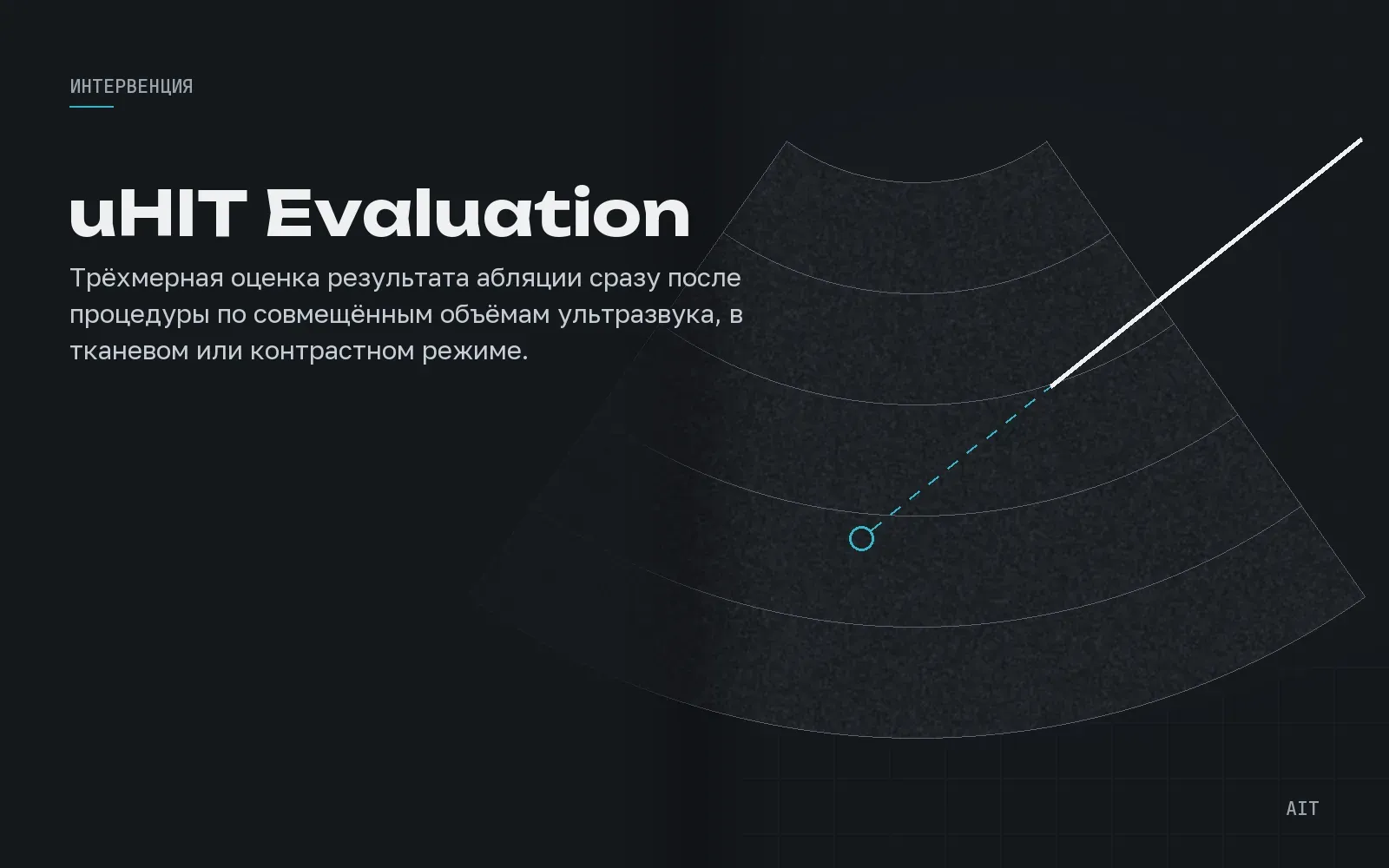 uHIT Evaluation, оценка края абляции