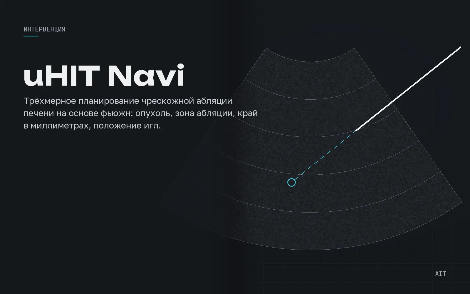 uHIT Navi, планирование абляции печени