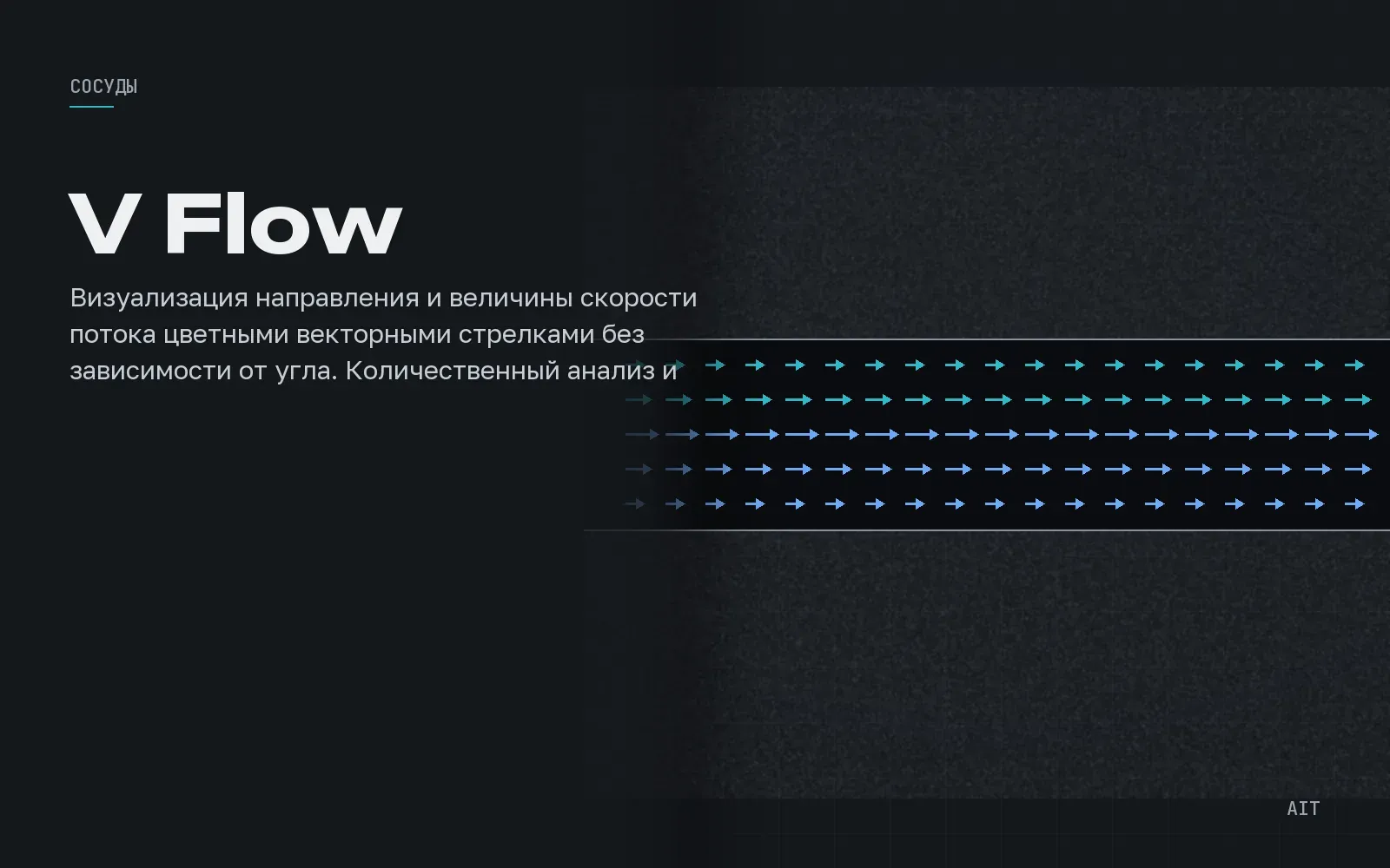 V Flow, векторный кровоток