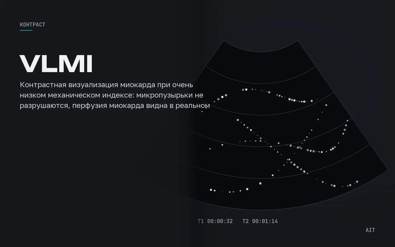 VLMI, контраст с очень низким механическим индексом