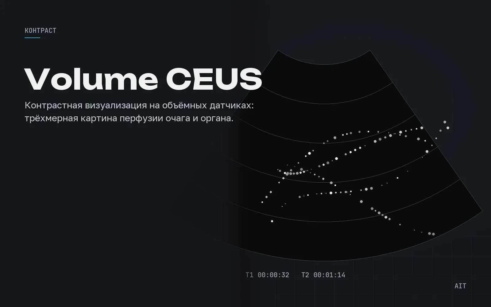Volume CEUS, объёмный контраст